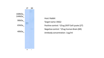 DSG2 Rabbit Polyclonal Antibody
