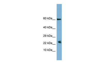 HBEGF Rabbit Polyclonal Antibody