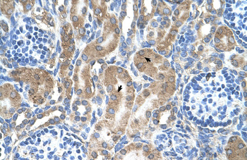 LRPAP1 Rabbit Polyclonal Antibody