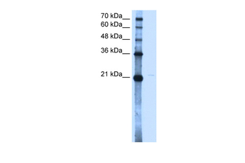 OLR1 Rabbit Polyclonal Antibody