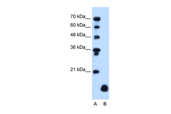 PLP2 Rabbit Polyclonal Antibody