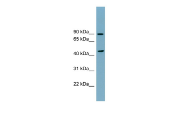 SMPD2 Rabbit Polyclonal Antibody