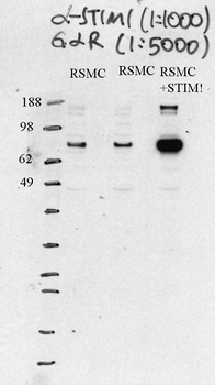 STIM1 Rabbit Polyclonal Antibody