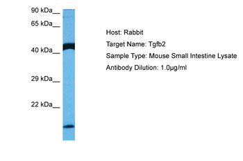 TGFB2 Rabbit Polyclonal Antibody
