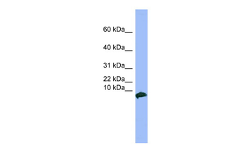 VIP Rabbit Polyclonal Antibody
