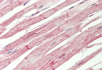 DYSF Rabbit Polyclonal Antibody