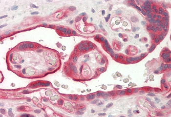 DYSF Rabbit Polyclonal Antibody