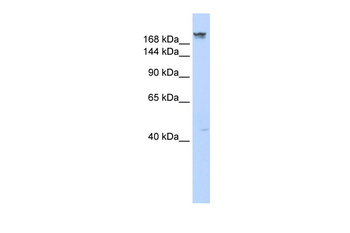 DYSF Rabbit Polyclonal Antibody