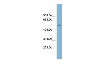 CHST1 Rabbit Polyclonal Antibody