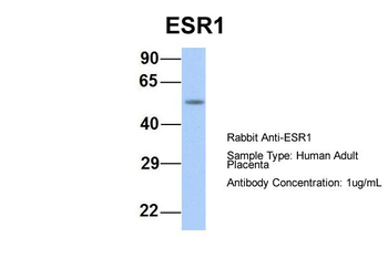 ESR1 Rabbit Polyclonal Antibody