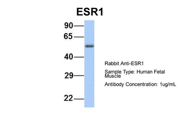ESR1 Rabbit Polyclonal Antibody