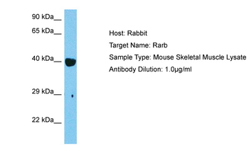 RARB Rabbit Polyclonal Antibody
