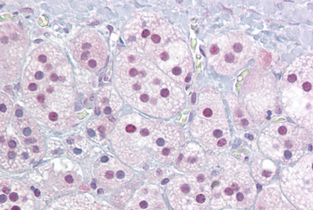 NR4A1 Rabbit Polyclonal Antibody