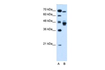 NR2F6 Rabbit Polyclonal Antibody