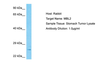 MBL2 Rabbit Polyclonal Antibody