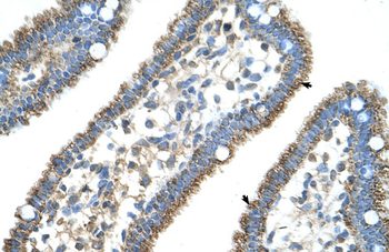 CPS1 Rabbit Polyclonal Antibody