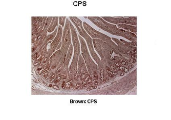 CPS1 Rabbit Polyclonal Antibody