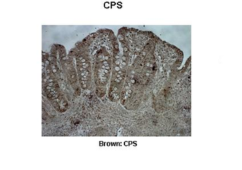 CPS1 Rabbit Polyclonal Antibody
