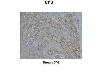 CPS1 Rabbit Polyclonal Antibody
