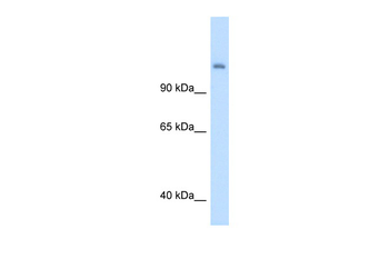CPS1 Rabbit Polyclonal Antibody