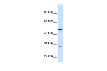 ECHS1 Rabbit Polyclonal Antibody