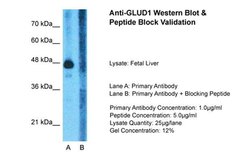 GLUD1 Rabbit Polyclonal Antibody