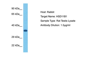 HSD11B1 Rabbit Polyclonal Antibody