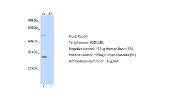 HSD11B1 Rabbit Polyclonal Antibody