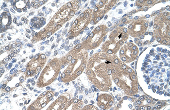 TDO2 Rabbit Polyclonal Antibody