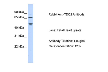 TDO2 Rabbit Polyclonal Antibody