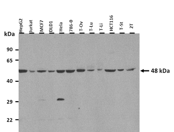 TDO2 Rabbit Polyclonal Antibody
