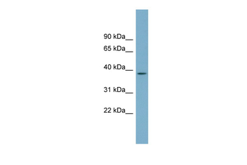 SDSL Rabbit Polyclonal Antibody