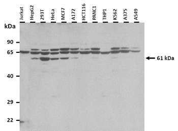 CBS Rabbit Polyclonal Antibody