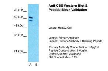 CBS Rabbit Polyclonal Antibody