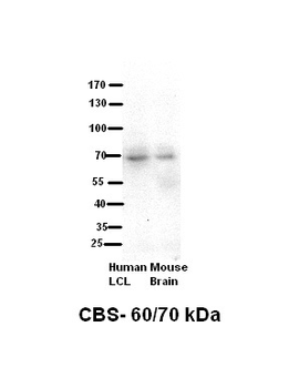 CBS Rabbit Polyclonal Antibody