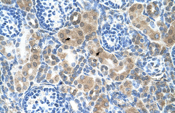 CBS Rabbit Polyclonal Antibody