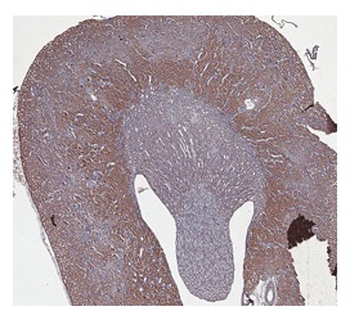 CBS Rabbit Polyclonal Antibody