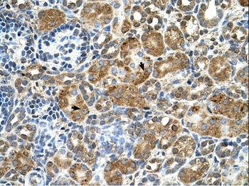 CSTB Rabbit Polyclonal Antibody