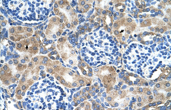 SOD1 Rabbit Polyclonal Antibody