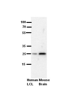 SH3BGR Rabbit Polyclonal Antibody