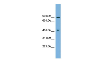 DYRK1A Rabbit Polyclonal Antibody