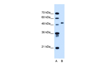 COL6A2 Rabbit Polyclonal Antibody