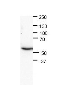 CHAF1B Rabbit Polyclonal Antibody