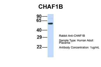 CHAF1B Rabbit Polyclonal Antibody