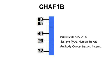 CHAF1B Rabbit Polyclonal Antibody