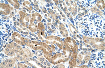 CHAF1B Rabbit Polyclonal Antibody