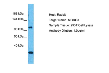 MORC3 Rabbit Polyclonal Antibody
