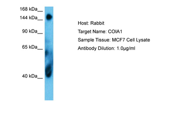 COL18A1 Rabbit Polyclonal Antibody