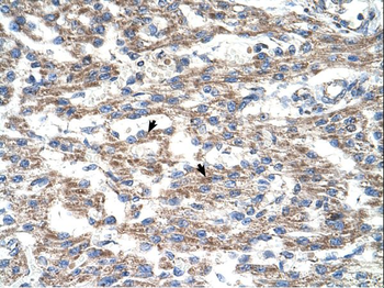 DUT Rabbit Polyclonal Antibody