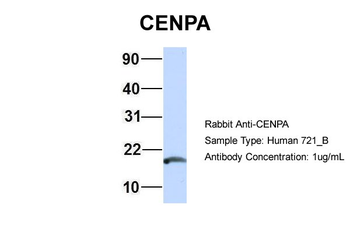 CENPA Rabbit Polyclonal Antibody